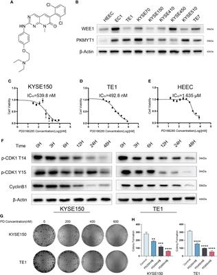 PD0166285 sensitizes esophageal squamous cell carcinoma to radiotherapy by dual inhibition of WEE1 and PKMYT1